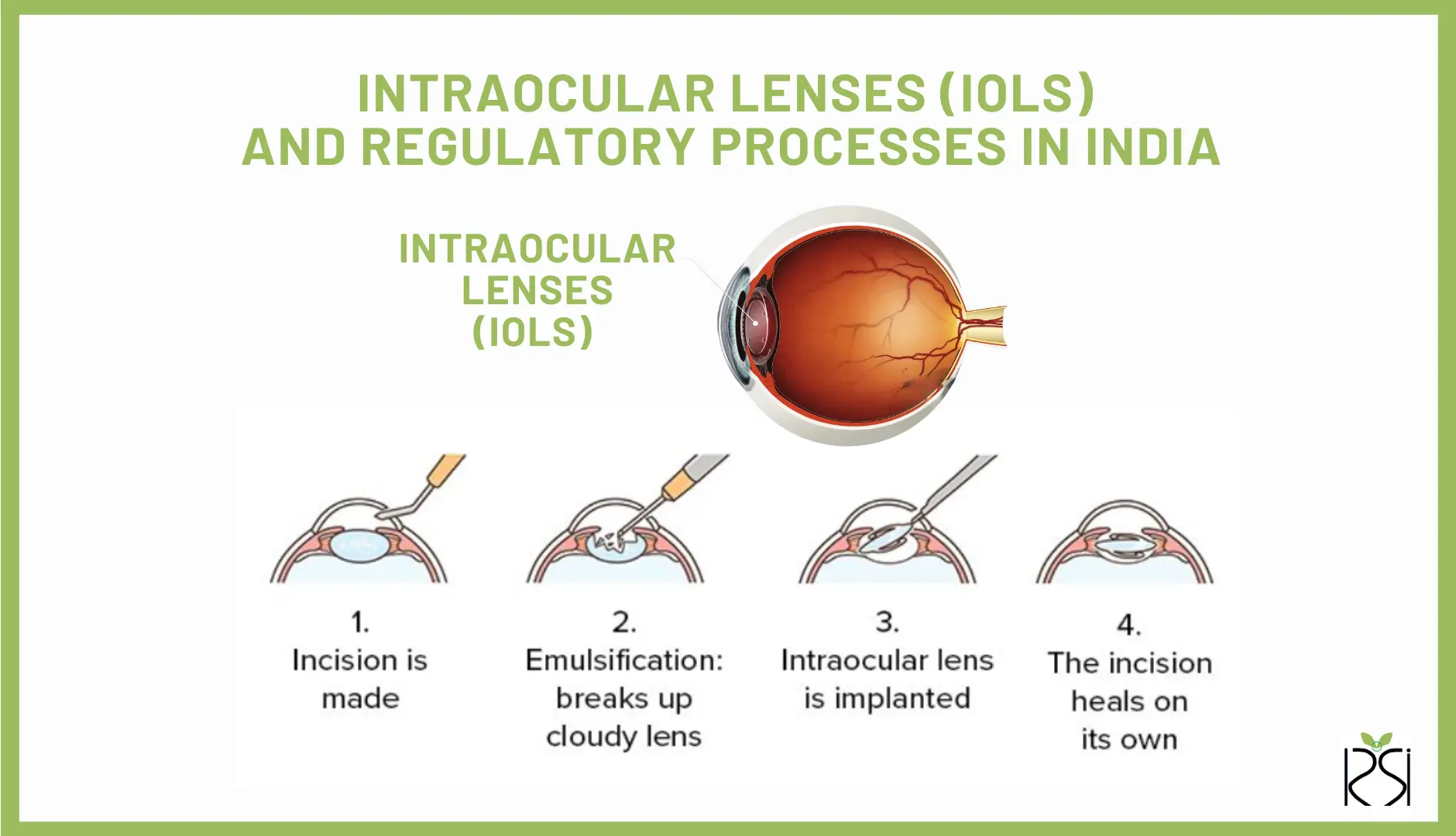 Intraocular lenses